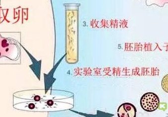 海口试管婴儿医院一览，助您选址无忧