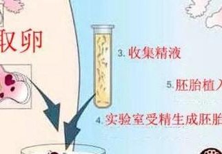 试管婴儿湖北十堰哪家医院好？一文告诉您