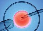 四川成都三代试管婴儿优势有哪些？